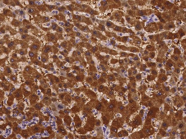 AMDHD1 Antibody - Immunochemical staining of human AMDHD1 in human liver with rabbit polyclonal antibody at 1:100 dilution, formalin-fixed paraffin embedded sections.