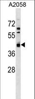AMDHD2 Antibody - AMDHD2 Antibody western blot of A2058 cell line lysates (35 ug/lane). The AMDHD2 antibody detected the AMDHD2 protein (arrow).