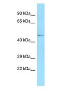 AMDHD2 Antibody - AMDHD2 antibody Western Blot of Fetal Kidney . Antibody dilution: 1 ug/ml.  This image was taken for the unconjugated form of this product. Other forms have not been tested.