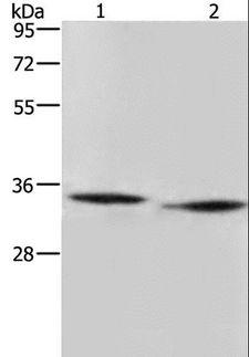 AMDHD2 Antibody - Western blot analysis of mouse heart and liver tissue, using AMDHD2 Polyclonal Antibody at dilution of 1:500.