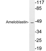 Ameloblastin / AMBN Antibody - Western blot analysis of lysates from HeLa cells, using Ameloblastin antibody.