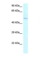 Ameloblastin / AMBN Antibody - AMBN antibody Western blot of Jurkat Cell lysate. Antibody concentration 1 ug/ml.  This image was taken for the unconjugated form of this product. Other forms have not been tested.