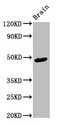 Ameloblastin / AMBN Antibody - Positive Western Blot detected in Rat brain tissue. All lanes: AMBN antibody at 4 µg/ml Secondary Goat polyclonal to rabbit IgG at 1/50000 dilution. Predicted band size: 49, 47 KDa. Observed band size: 49 KDa