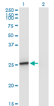 AMELX Antibody - Western Blot analysis of AMELX expression in transfected 293T cell line by AMELX monoclonal antibody (M02A), clone 5B2.Lane 1: AMELX transfected lysate (Predicted MW: 21.6 KDa).Lane 2: Non-transfected lysate.