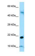 AMELY Antibody - AMELY antibody Western Blot of Human Thymus.  This image was taken for the unconjugated form of this product. Other forms have not been tested.