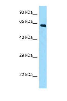 AMER2 Antibody - Fam123a antibody Western blot of Mouse Kidney lysate. Antibody concentration 1 ug/ml.  This image was taken for the unconjugated form of this product. Other forms have not been tested.