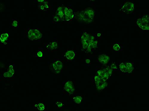 AMH / Anti-Mullerian Hormone Antibody - Immunofluorescence staining of AMH in MCF7 cells. Cells were fixed with 4% PFA, permeabilzed with 0.1% Triton X-100 in PBS, blocked with 10% serum, and incubated with rabbit anti-Human AMH polyclonal antibody (dilution ratio 1:200) at 4°C overnight. Then cells were stained with the Alexa Fluor 488-conjugated Goat Anti-rabbit IgG secondary antibody (green). Positive staining was localized to Cytoplasm.