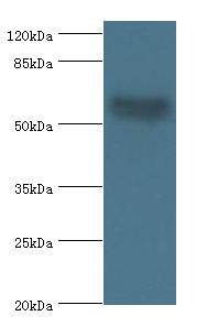 AMH / Anti-Mullerian Hormone Antibody - Western blot. All lanes: Muellerian-inhibiting factor antibody at 2 ug/ml+mouse small intestine tissue. Secondary antibody: Goat polyclonal to rabbit at 1:10000 dilution. Predicted band size: 59 kDa. Observed band size: 59 kDa.  This image was taken for the unconjugated form of this product. Other forms have not been tested.