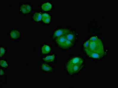 AMH / Anti-Mullerian Hormone Antibody - Immunofluorescent analysis of MCF-7 cells using AMH Antibody at dilution of 1:100 and Alexa Fluor 488-congugated AffiniPure Goat Anti-Rabbit IgG(H+L)