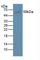 AMH / Anti-Mullerian Hormone Antibody