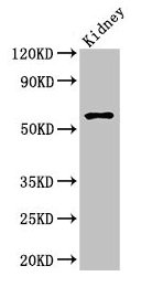 AMH / Anti-Mullerian Hormone Antibody - Western Blot Positive WB detected in: mouse kidney tissue All lanes: Amh antibody at 2.7µg/ml Secondary Goat polyclonal to rabbit IgG at 1/50000 dilution Predicted band size: 60 kDa Observed band size: 60 kDa
