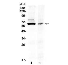 AMH / Anti-Mullerian Hormone Antibody - Western blot testing of human 1) 293T and 2) COLO320 lysate with AMH antibody at 0.5ug/ml. Predicted molecular weight ~60 kDa. Glycosylated homodimer may be seen at ~ 140 kDa.