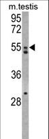 AMHR2 / MISRII Antibody - Western blot of AMHR2 Antibody in mouse testis tissue lysates (35 ug/lane). AMHR2 (arrow) was detected using the purified antibody.