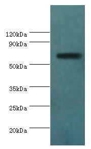 AMHR2 / MISRII Antibody - Western blot. All lanes: Anti-Muellerian hormone type-2 receptor antibody at 15 ug/ml+mouse brain tissue. Secondary antibody: Goat polyclonal to rabbit at 1:10000 dilution. Predicted band size: 63 kDa. Observed band size: 63 kDa.