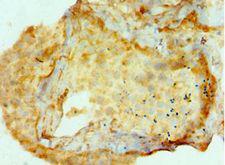 AMHR2 / MISRII Antibody - Immunohistochemistry of paraffin-embedded human testis using antibody at 1:100 dilution.