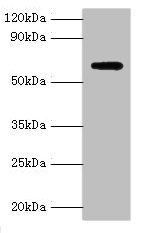 AMHR2 / MISRII Antibody - Western blot All lanes: Anti-Muellerian hormone type-2 receptor antibody at 15µg/ml + Mouse brain tissue Secondary Goat polyclonal to rabbit IgG at 1/10000 dilution Predicted band size: 63, 53, 52 kDa Observed band size: 63 kDa