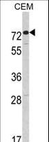AMHR2 / MISRII Antibody - Western blot of AMHR2 Antibody in CEM cell line lysates (35 ug/lane). AMHR2 (arrow) was detected using the purified antibody.