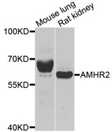 AMHR2 / MISRII Antibody - Western blot analysis of extracts of various cell lines.