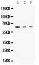 AMHR2 / MISRII Antibody - Western blot analysis of AMHR2 expression in rat skeletal muscle extract (lane 1), HELA whole cell lysates (lane 2) and MCF-7 whole cell lysates (lane 3). AMHR2 at 63KD was detected using rabbit anti-AMHR2 Antigen Affinity purified polyclonal antibody at 0.5 ug/ml. The blot was developed using chemiluminescence (ECL) method.