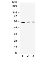 AMHR2 / MISRII Antibody - Western blot testing of 1) rat skeletal muscle, 2) human HeLa and 3) human MCF7 lysate with AMHR2 antibody at 0.5ug/ml. Predicted molecular weight: ~63 kDa.