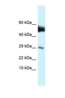 AMHR2 / MISRII Antibody - AMHR2 antibody western blot of Mouse Brain lysate. Antibody concentration 1 ug/ml.  This image was taken for the unconjugated form of this product. Other forms have not been tested.