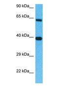 AMHR2 / MISRII Antibody - Western blot of AMHR2 Antibody with human 721_B Whole Cell lysate.  This image was taken for the unconjugated form of this product. Other forms have not been tested.