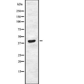 AMICA / JAML Antibody - Western blot analysis of JAML1 expression in HEK293 cells. The lane on the left is treated with the antigen-specific peptide.