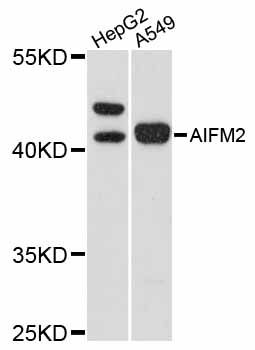 AMID / AIFM2 Antibody - Western blot analysis of extracts of various cell lines, using AIFM2 antibody at 1:1000 dilution. The secondary antibody used was an HRP Goat Anti-Rabbit IgG (H+L) at 1:10000 dilution. Lysates were loaded 25ug per lane and 3% nonfat dry milk in TBST was used for blocking. An ECL Kit was used for detection and the exposure time was 15s.