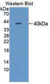 AMIGO Antibody - Western blot of AMIGO antibody.