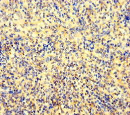 AMIGO Antibody - Immunohistochemistry of paraffin-embedded human spleen tissue using AMIGO1 Antibody at dilution of 1:100