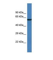 AMIGO2 Antibody - Western blot of Human RPMI-8226. AMIGO2 antibody dilution 1.0 ug/ml.  This image was taken for the unconjugated form of this product. Other forms have not been tested.