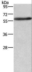 AMIGO2 Antibody - Western blot analysis of A172 cell, using AMIGO2 Polyclonal Antibody at dilution of 1:597.