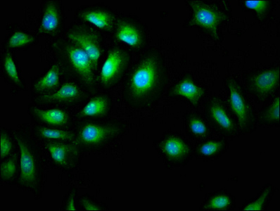 AMIGO2 Antibody - Immunofluorescence staining of A549 cells diluted at 1:266,counter-stained with DAPI. The cells were fixed in 4% formaldehyde, permeabilized using 0.2% Triton X-100 and blocked in 10% normal Goat Serum. The cells were then incubated with the antibody overnight at 4°C.The Secondary antibody was Alexa Fluor 488-congugated AffiniPure Goat Anti-Rabbit IgG (H+L).