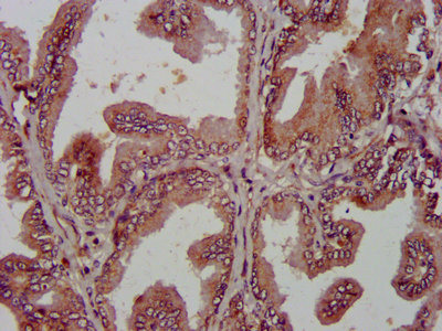 AMIGO2 Antibody - Immunohistochemistry Dilution at 1:800 and staining in paraffin-embedded human prostate tissue performed on a Leica BondTM system. After dewaxing and hydration, antigen retrieval was mediated by high pressure in a citrate buffer (pH 6.0). Section was blocked with 10% normal Goat serum 30min at RT. Then primary antibody (1% BSA) was incubated at 4°C overnight. The primary is detected by a biotinylated Secondary antibody and visualized using an HRP conjugated SP system.