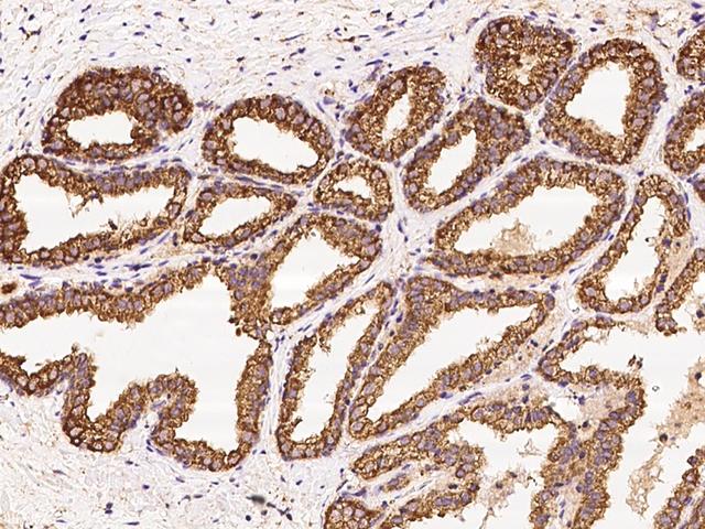 AMIGO2 Antibody - Immunochemical staining of human AMIGO2 in human prostate with rabbit polyclonal antibody at 1:100 dilution, formalin-fixed paraffin embedded sections.