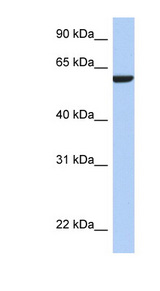 AMIGO3 Antibody - AMIGO3 antibody Western blot of MCF7 cell lysate. This image was taken for the unconjugated form of this product. Other forms have not been tested.