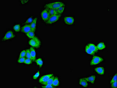 Amisyn / STXBP6 Antibody - Immunofluorescent analysis of HepG2 cells using STXBP6 Antibody at dilution of 1:100 and Alexa Fluor 488-congugated AffiniPure Goat Anti-Rabbit IgG(H+L)
