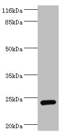 Amisyn / STXBP6 Antibody - Western blot All lanes: STXBP6 antibody at 2µg/ml + Mouse brain tissue Secondary Goat polyclonal to rabbit IgG at 1/10000 dilution Predicted band size: 24, 12 kDa Observed band size: 24 kDa