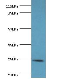 Amisyn / STXBP6 Antibody - Western blot. All lanes: STXBP6 antibody at 2 ug/ml+mouse brain tissue. Secondary antibody: Goat polyclonal to rabbit at 1:10000 dilution. Predicted band size: 24 kDa. Observed band size: 24 kDa.  This image was taken for the unconjugated form of this product. Other forms have not been tested.