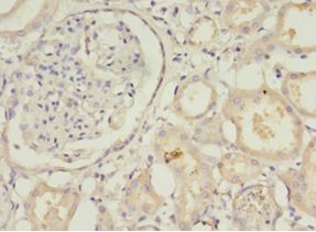 Amisyn / STXBP6 Antibody - Immunohistochemistry of paraffin-embedded human kidney using antibody at 1:100 dilution.  This image was taken for the unconjugated form of this product. Other forms have not been tested.