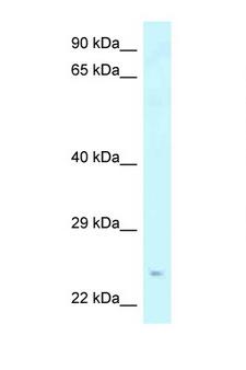 Amisyn / STXBP6 Antibody - STXBP6 antibody Western blot of Mouse Thymus lysate. Antibody concentration 1 ug/ml.  This image was taken for the unconjugated form of this product. Other forms have not been tested.