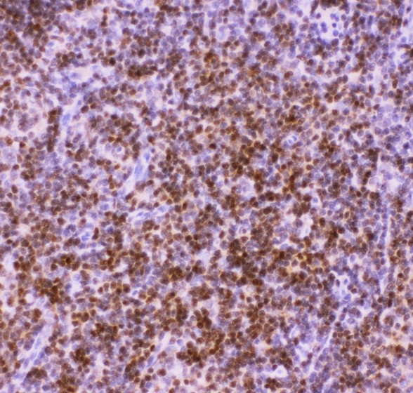 AML1 / RUNX1 Antibody - RUNX1/AML1 antibody IHC-paraffin: Rat Thymus Tissue.