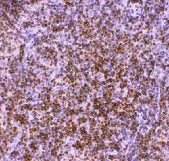 AML1 / RUNX1 Antibody - Anti-RUNX1/AML1 Picoband antibody, IHC(P): Rat Thymus Tissue