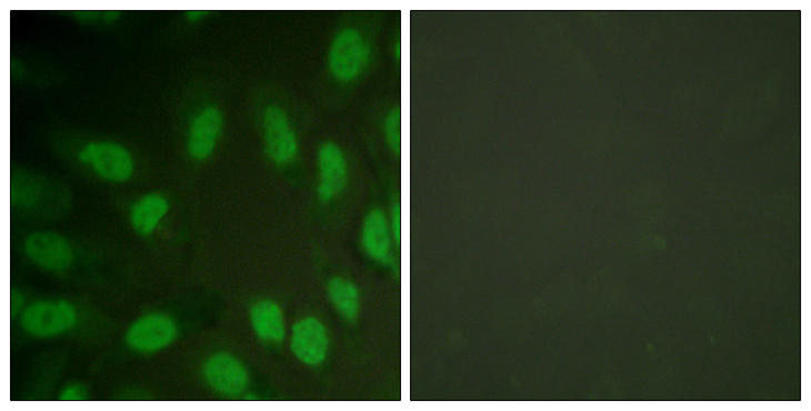 AML1 / RUNX1 Antibody - Immunofluorescence analysis of HeLa cells, using AML1 Antibody. The picture on the right is blocked with the synthesized peptide.