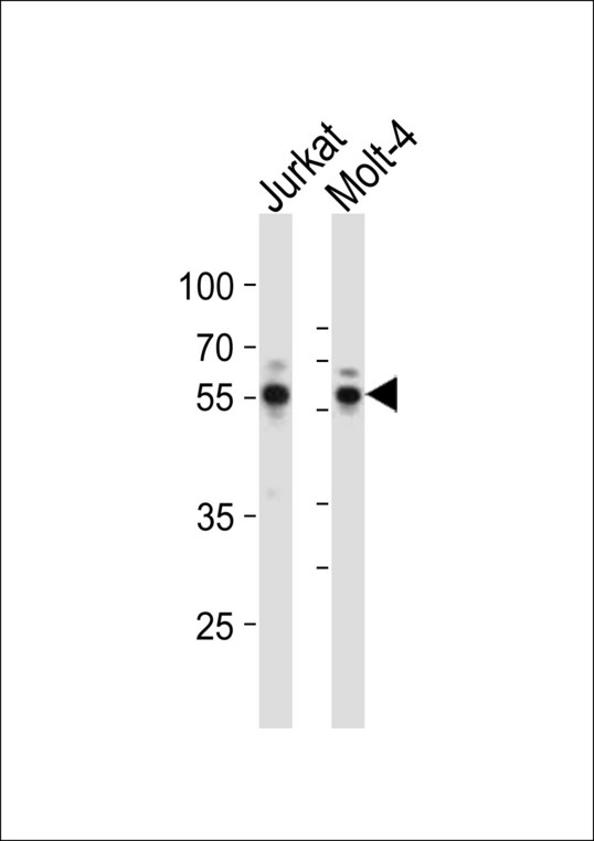 AML1 / RUNX1 Antibody - Western blot of lysates from Jurkat, Molt-4 cell line (from left to right), using RUNX1 antibody diluted at 1:1000 at each lane. A goat anti-rabbit IgG H&L (HRP) at 1:10000 dilution was used as the secondary antibody. Lysates at 20 ug per lane.