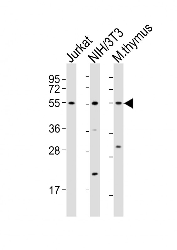 AML1 / RUNX1 Antibody - All lanes : Anti-Runx1 Antibody at 1:2000 dilution Lane 1: Jurkat whole cell lysates Lane 2: NIH/3T3 whole cell lysates Lane 3: mouse thymus lysates Lysates/proteins at 20 ug per lane. Secondary Goat Anti-Rabbit IgG, (H+L), Peroxidase conjugated at 1/10000 dilution Predicted band size : 49 kDa Blocking/Dilution buffer: 5% NFDM/TBST.