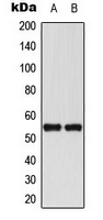 AML1 / RUNX1 Antibody - Western blot analysis of RUNX1 expression in THP1 (A); Jurkat (B) whole cell lysates.