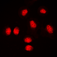 AML1 / RUNX1 Antibody - Immunofluorescent analysis of RUNX1 staining in THP1 cells. Formalin-fixed cells were permeabilized with 0.1% Triton X-100 in TBS for 5-10 minutes and blocked with 3% BSA-PBS for 30 minutes at room temperature. Cells were probed with the primary antibody (1:500) in 3% BSA-PBS and incubated overnight at 4 C in a humidified chamber. Cells were washed with PBST and incubated with a DyLight 594-conjugated secondary antibody (red) in PBS at room temperature in the dark. DAPI was used to stain the cell nuclei (blue).