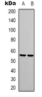 AML1 / RUNX1 Antibody - Western blot analysis of RUNX1 expression in Jurkat (A); THP1 (B) whole cell lysates.