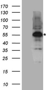 AML1 / RUNX1 Antibody - HEK293T cells were transfected with the pCMV6-ENTRY control. (Left lane) or pCMV6-ENTRY RUNX1. (Right lane) cDNA for 48 hrs and lysed